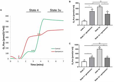 Gentamicin Affects the Bioenergetics of Isolated Mitochondria and Collapses the Mitochondrial Membrane Potential in Cochlear Sensory Hair Cells